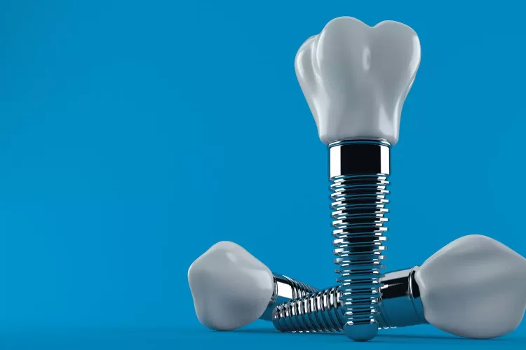 Dental Implant Brands