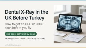 Smile Dental Turkey Dental X-ray in the UK before treatment in Turkey: a tablet showing a panoramic OPG scan beside an appointment card and referral form, with the £50 scan offer from Smile Dental Turkey